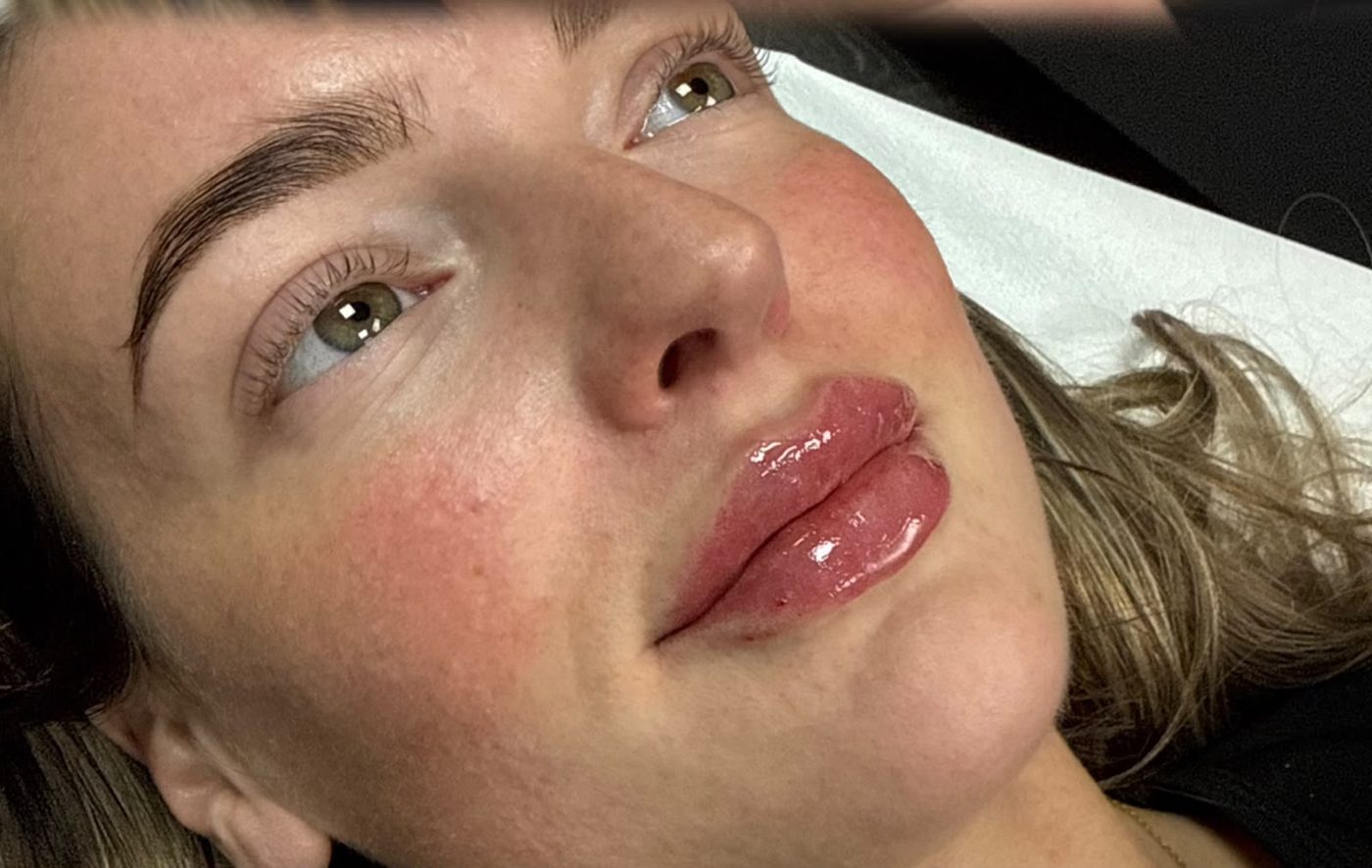 Natural lip enhancement results at Her Haus Aesthetics